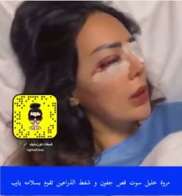 مروة خليل